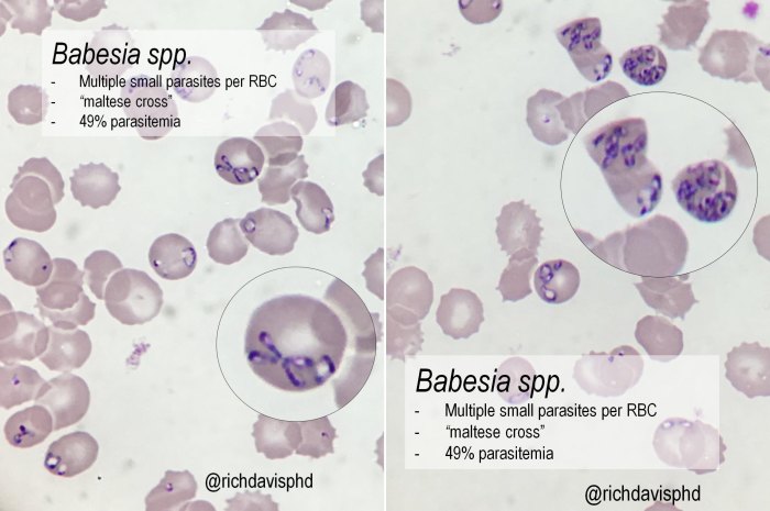 Peripheral blood smear questions and answers