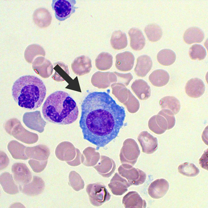 Peripheral blood smear questions and answers