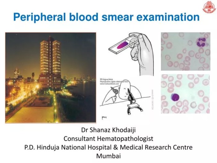 Blood identify constituents smear micrograph dragging platelet erythrocyte neutrophil lymphocyte transcribed plasma